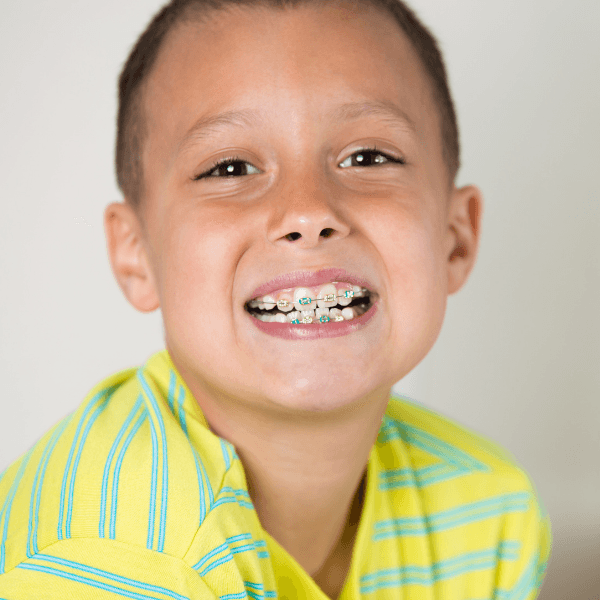 Early Orthodontics