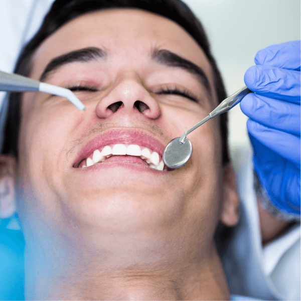 Fluoride Treatments
