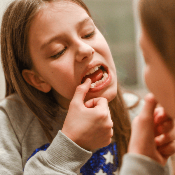 Loose or Dislodged Tooth